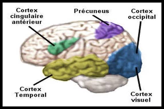 Les régions du cerveau activées sous hypnose